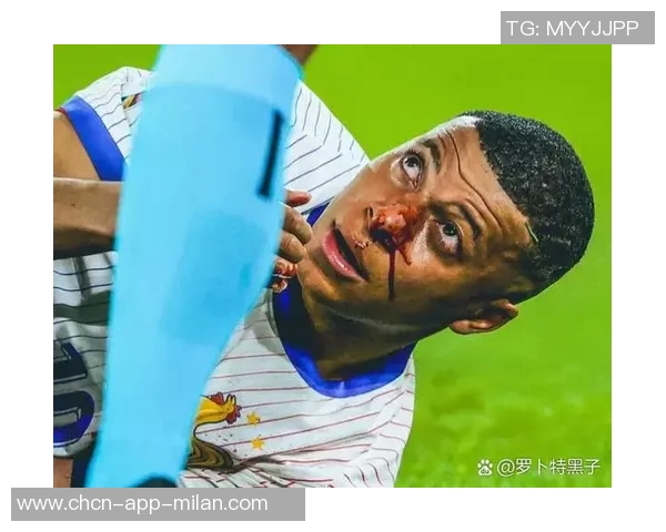 姆巴佩因脚踝扭伤缺席法国队首场训练正在积极接受治疗 姆巴佩因脚踝扭伤缺席法国队首场训练正在积极接受治疗